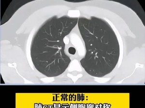 www17ctom是一个专业的 CT 技术交流网站