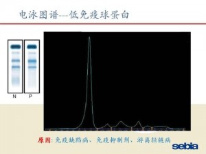 探秘血清世界的乐趣：游戏特色深入解析