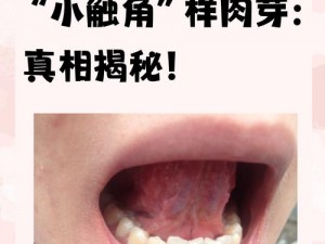 舌头能舔到口腔下颚有硬疙瘩图片：口腔健康小常识