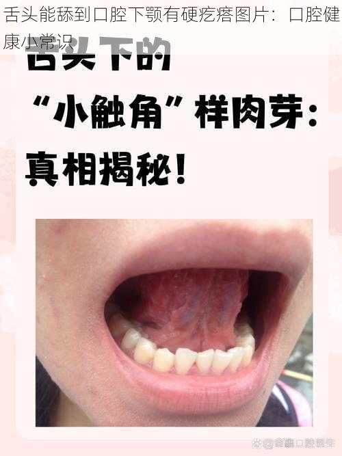 舌头能舔到口腔下颚有硬疙瘩图片：口腔健康小常识