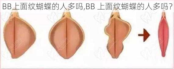 BB上面纹蝴蝶的人多吗,BB 上面纹蝴蝶的人多吗？